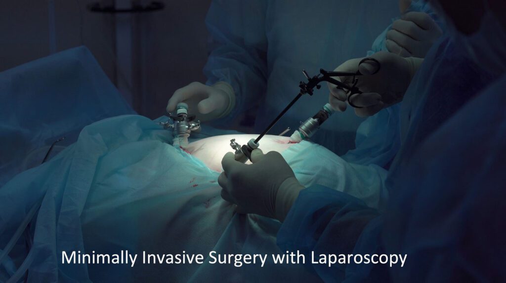 Minimally Invasive Liver Surgery In Singapore | LS Lee Surgery Clinic