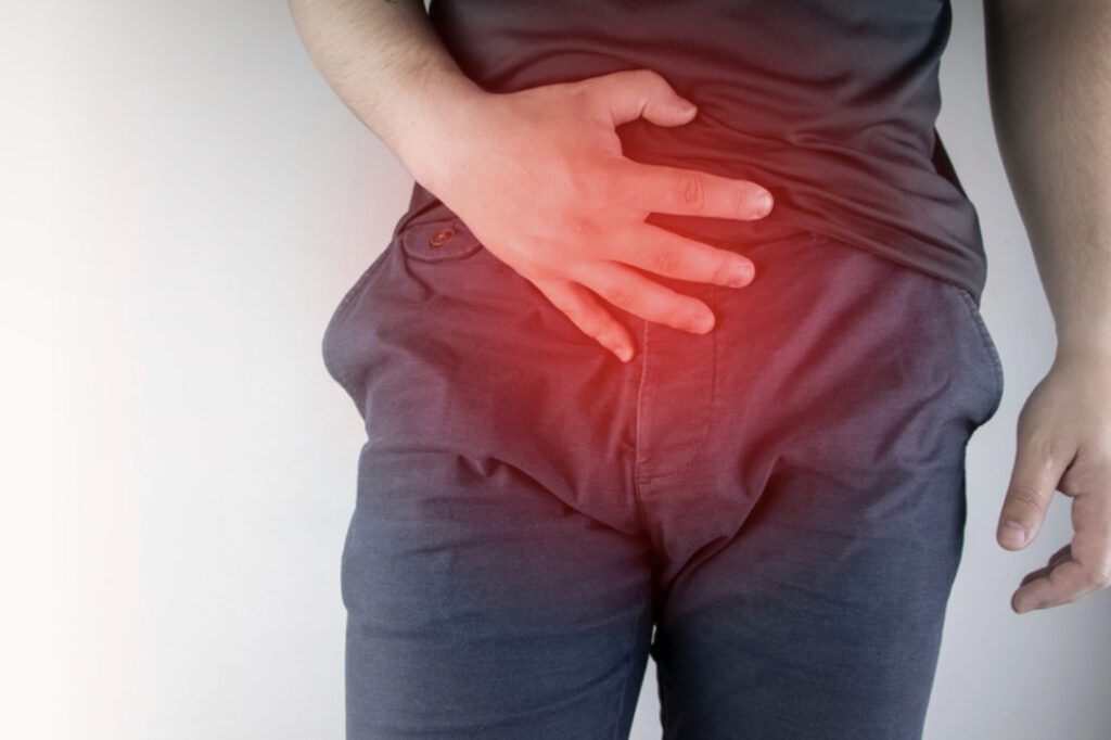Inguinal Hernia