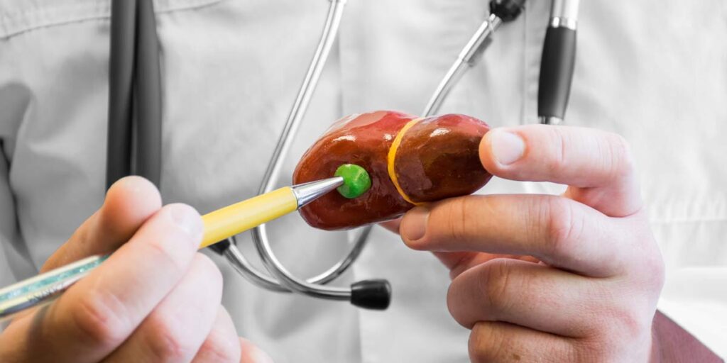 Can Gallbladder Polyps Turn Cancerous? Understand the Risks