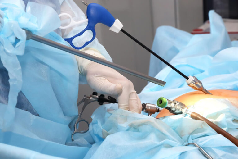 What’s the Difference Between Keyhole vs Open Gallbladder Surgery