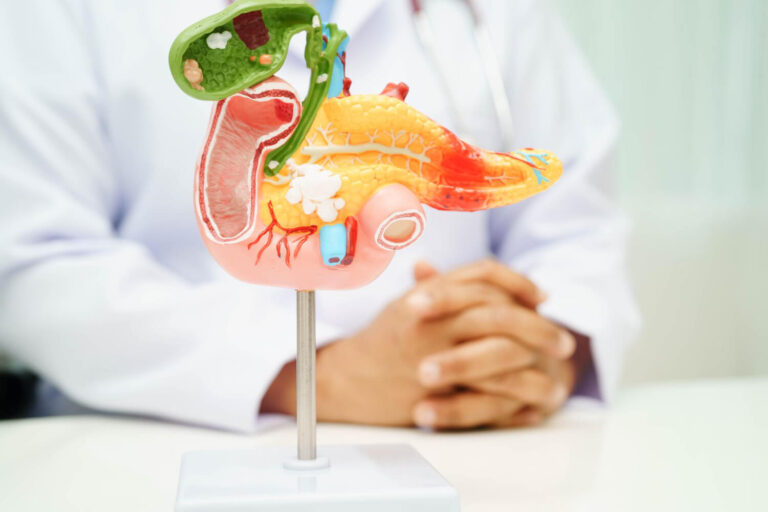 What Are the Early Symptoms of Bile Duct Cancer