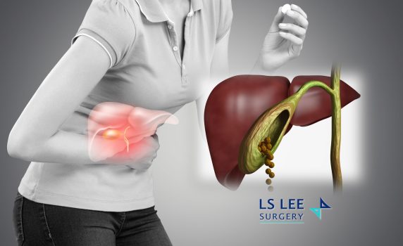 Acute Cholecystitis abdominal pain