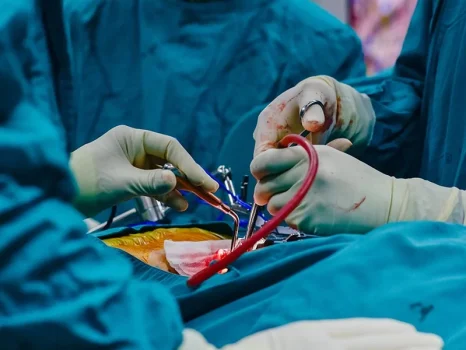 Pancreas surgery